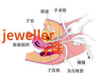 配一副陌森的近视眼镜多少钱我去问问店里的人