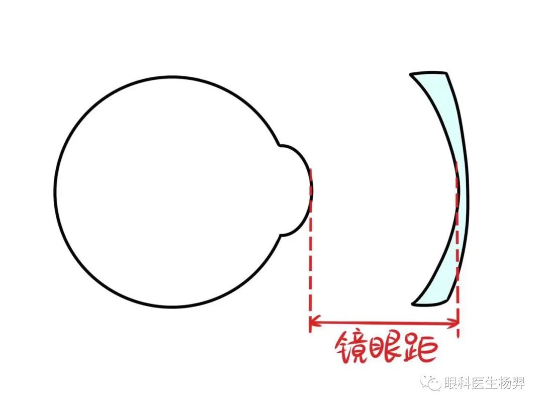 眼镜框架材质_框架眼镜_最轻的眼镜框架/