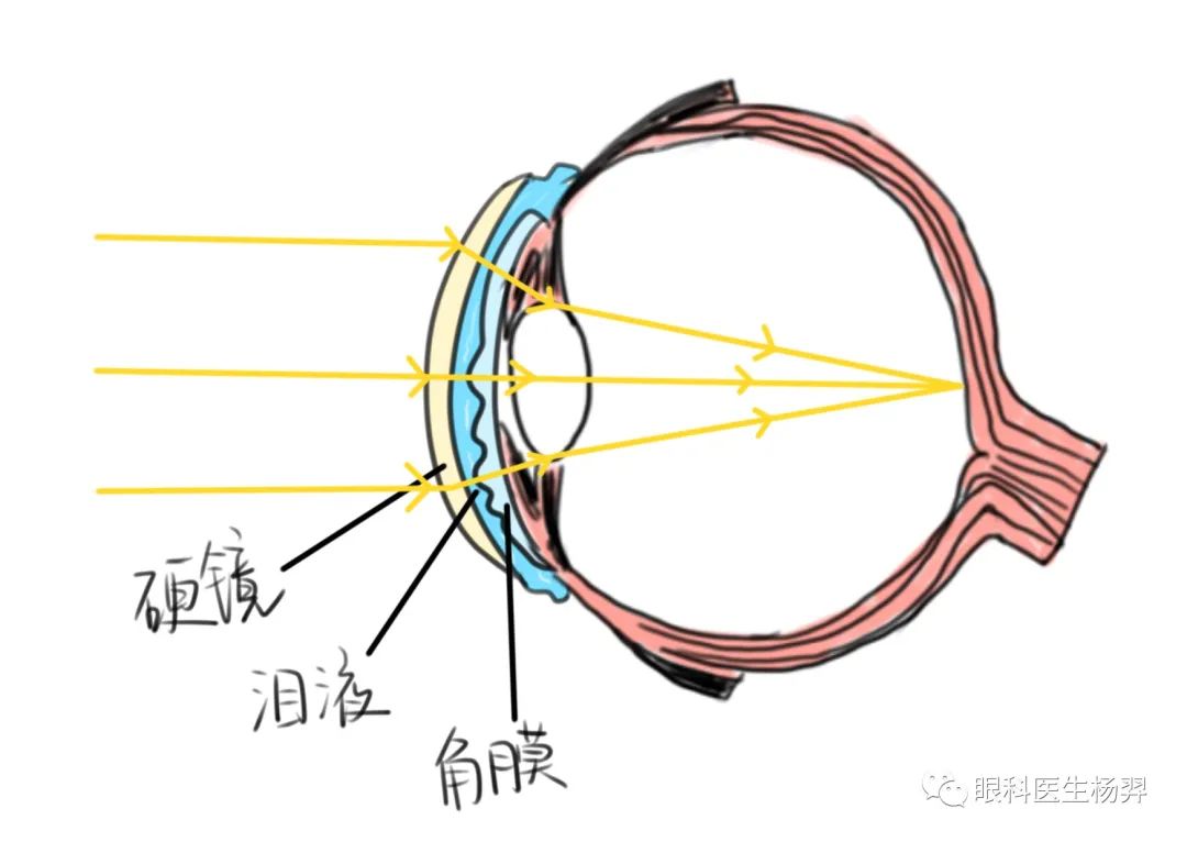 眼镜框架材质_最轻的眼镜框架_框架眼镜/